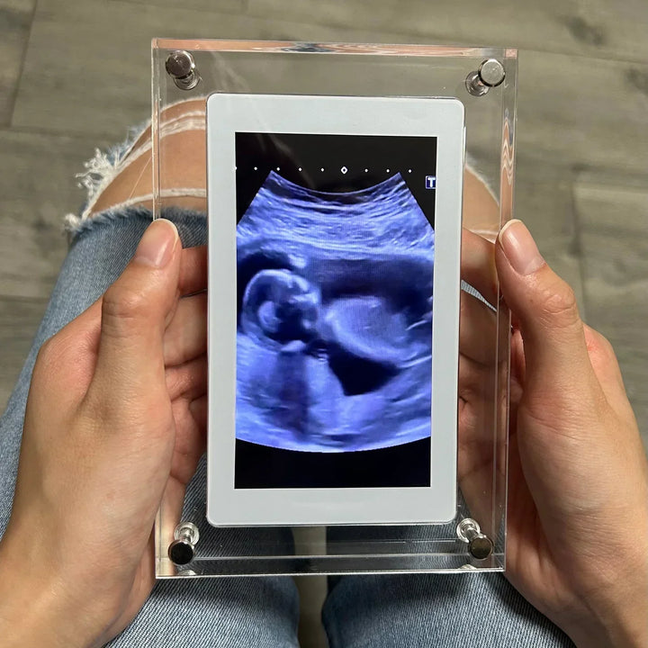 "10-tums smart digital fotoram med HD-pekskärm och WiFi, visar levande bilder, perfekt för modern inredning."