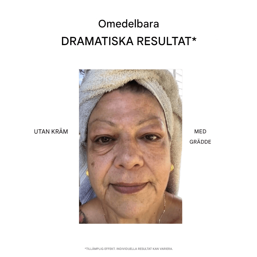 Återfuktande Ansiktskräm för Friskare Hud