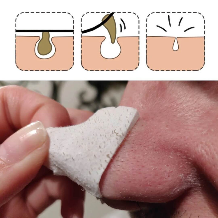 "Ansiktsmask med pappersremsor för effektiv behandling av pormaskar och igentäppta porer i ansikte, skonsam hudvård."