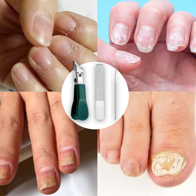 "Elegant 3-delad nagelvårdset: snedkantad nagelklippare, nano glas nagelfil, ergonomisk rengörare för proffsvård hemma."