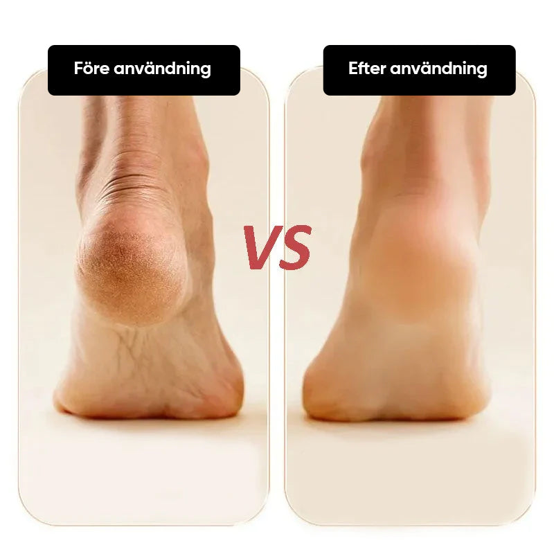 "Elektrisk fotslip med LCD-skärm, ergonomisk design, perfekt för att ta bort förhårdnader och vårda fötternas hälsa."