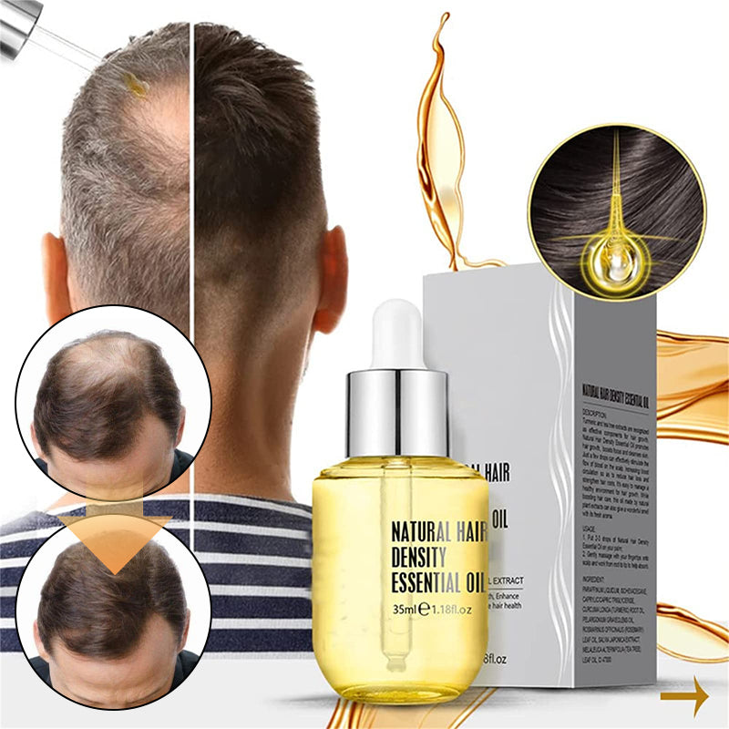 "Flaska med naturlig ingefära- och rosmarinolja för hårväxt, ger näring och främjar fylligare, friskare hår."