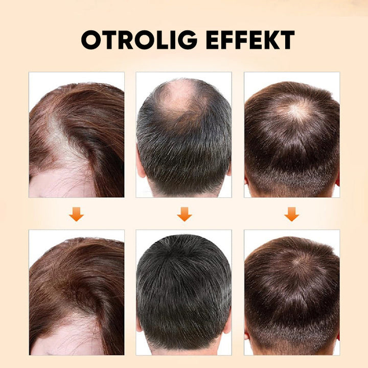 "Flaska med naturlig ingefära- och rosmarinolja för hårväxt, ger näring och främjar fylligare, friskare hår."