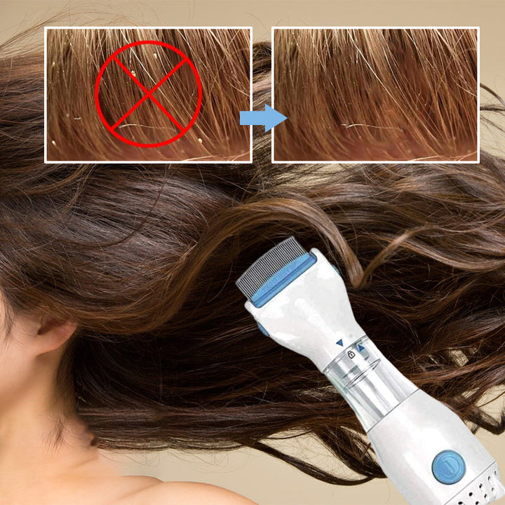 "Huvudlössmaskin med 3 filter, vit, blått LED-ljus, rostfri kam. Idealisk för kemikaliefri lössborttagning."