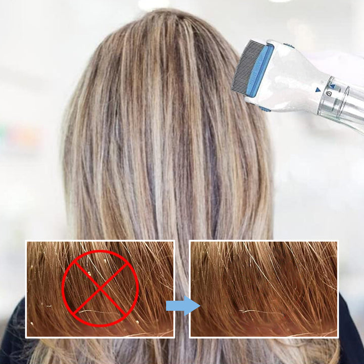 "Huvudlössmaskin med 3 filter, vit, blått LED-ljus, rostfri kam. Idealisk för kemikaliefri lössborttagning."