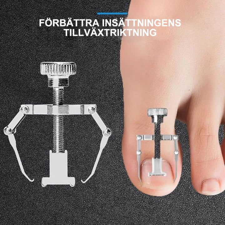 "Nagelklippare i medicinskt stål, ergonomiskt handtag, precisionsklippare för inåtväxande och tjocka naglar."