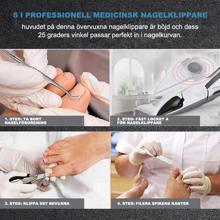 "Nagelklippare i medicinskt stål, ergonomiskt handtag, precisionsklippare för inåtväxande och tjocka naglar."
