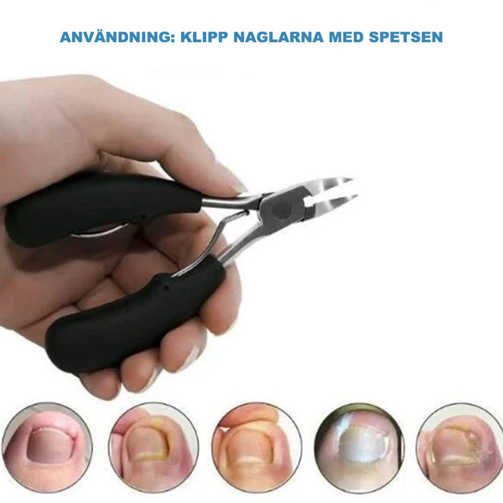 "Nagelklippare i medicinskt stål, ergonomiskt handtag, precisionsklippare för inåtväxande och tjocka naglar."