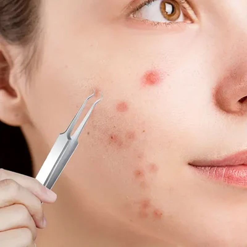"Samlingsbild av rostfritt pincettset för pormaskborttagning, med olika spetsar för hög precision och enkel hudvårdsrutin."