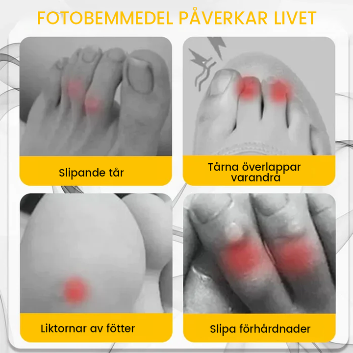 "Silikon tåskydd i genomskinligt material för personlig komfort och smärtlindring, idealiska för liktornar och blåsor."