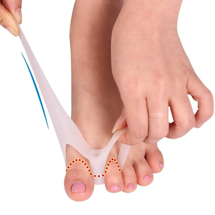 Silikon tåspridare för Hallux Valgus, diskret design, flexibel och ergonomisk för daglig komfort och smärtlindring.