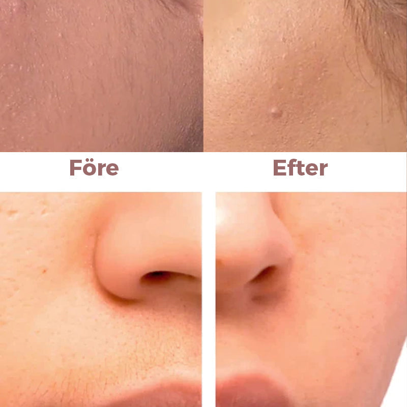 "Smärtfri ansiktsepilator i elegant läppstiftsdesign, perfekt för diskret hårborttagning, USB-laddning, bärbar."